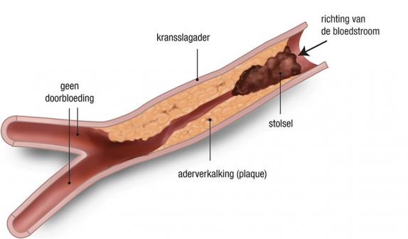 H1 3afsluiting